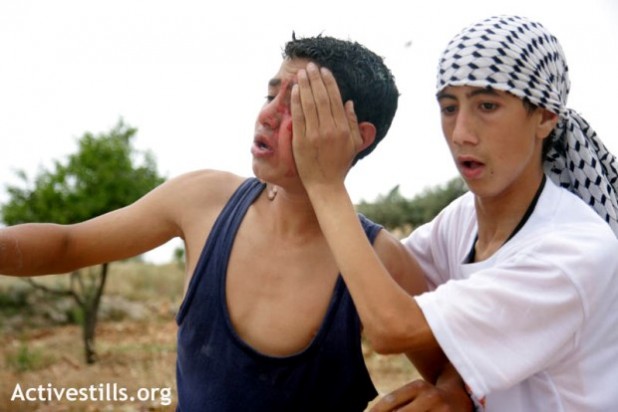 Injured Palestinian youth